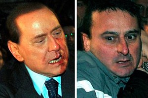 Сильвио Берлускони после получения удара по лицу